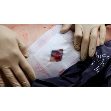 Оклюзійна Пов'язка Наліпка Невентильована Safeguard Medical Russell Chest Seal